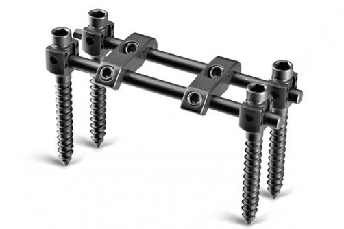 Anterior Thoracic Lumbar SystemⅡ