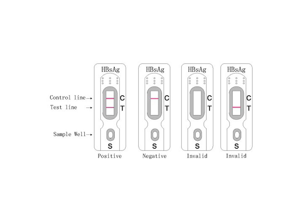 Shanghai Iven Medical Technology Co.,Ltd.’s superior Diagnostic Kit for