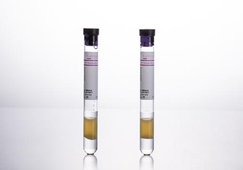 Mononuclear Cell Tube（CPT）